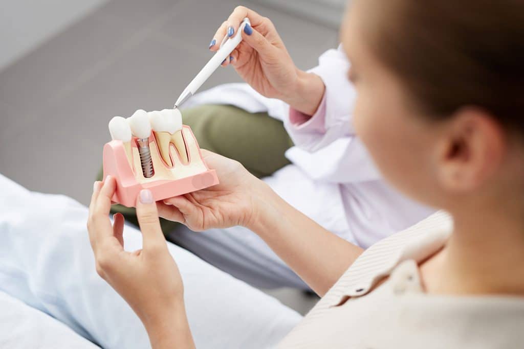 4 Myths About Dental Implants